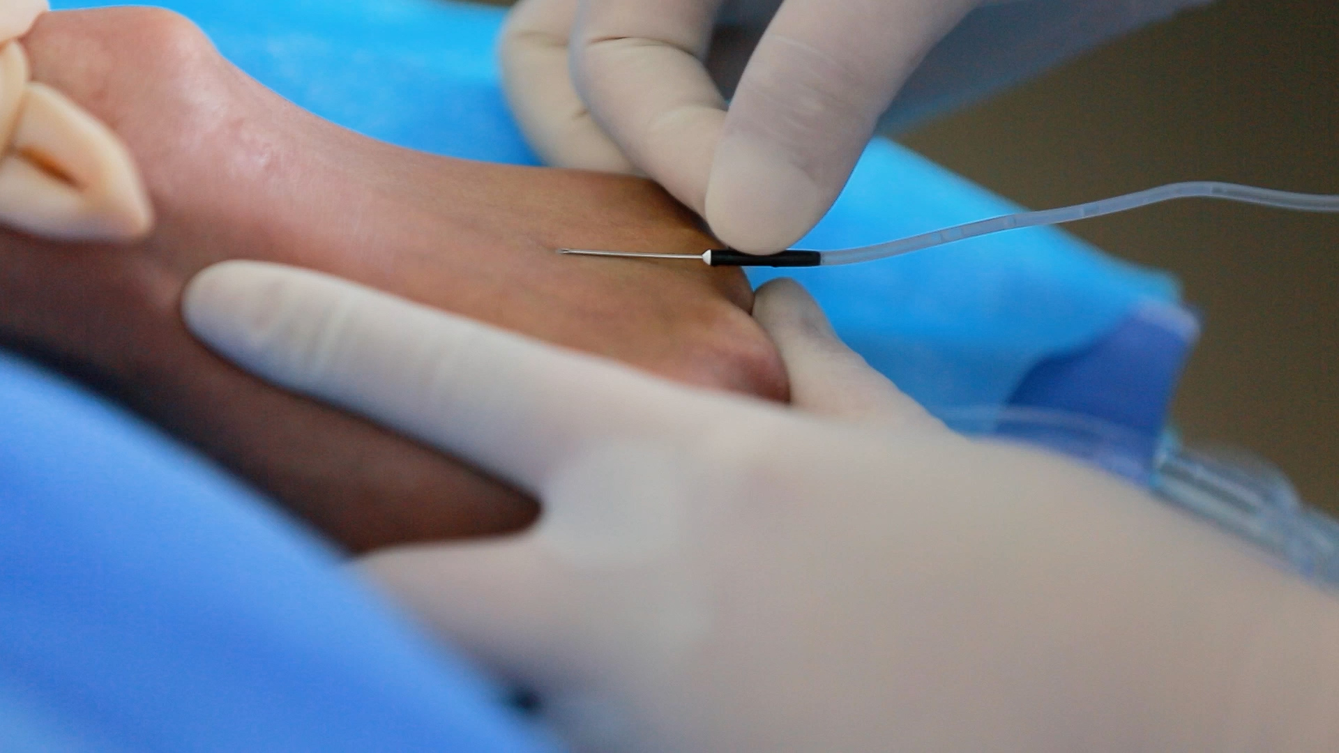 四川省戒毒管理局戒毒医疗专题片